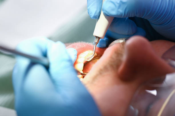 Best Chipped Tooth Repair Near Me  in Ritzville, WA